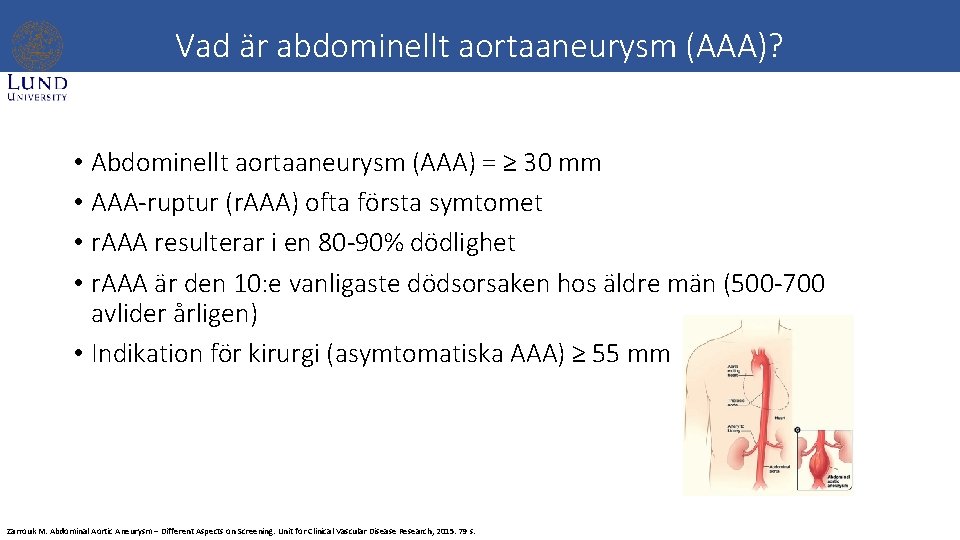 Vad är abdominellt aortaaneurysm (AAA)? • Abdominellt aortaaneurysm (AAA) = ≥ 30 mm •