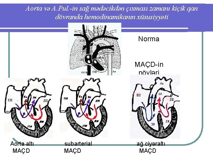 Aorta və A. Pul. -in sağ mədəcikdən çıxması zamanı kiçik qan dövranda hemodinamikanın xüsusiyyəti