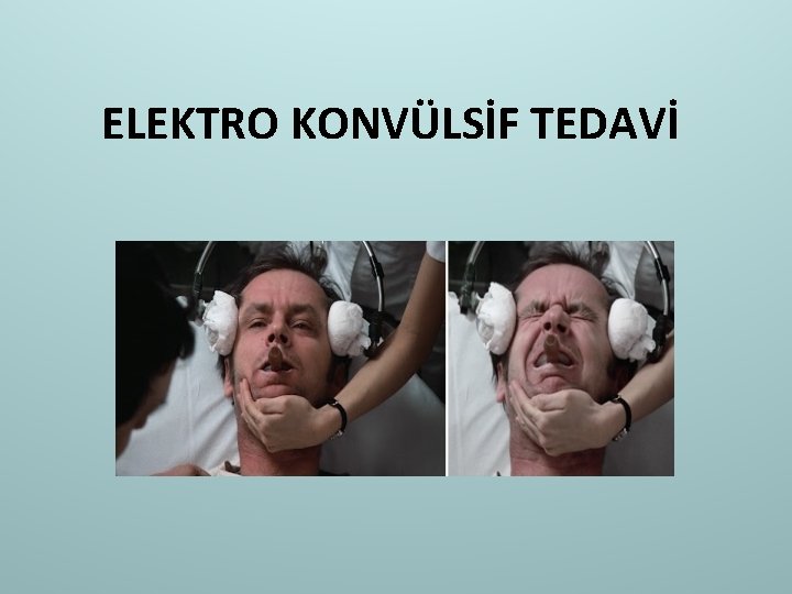 ELEKTRO KONVÜLSİF TEDAVİ 