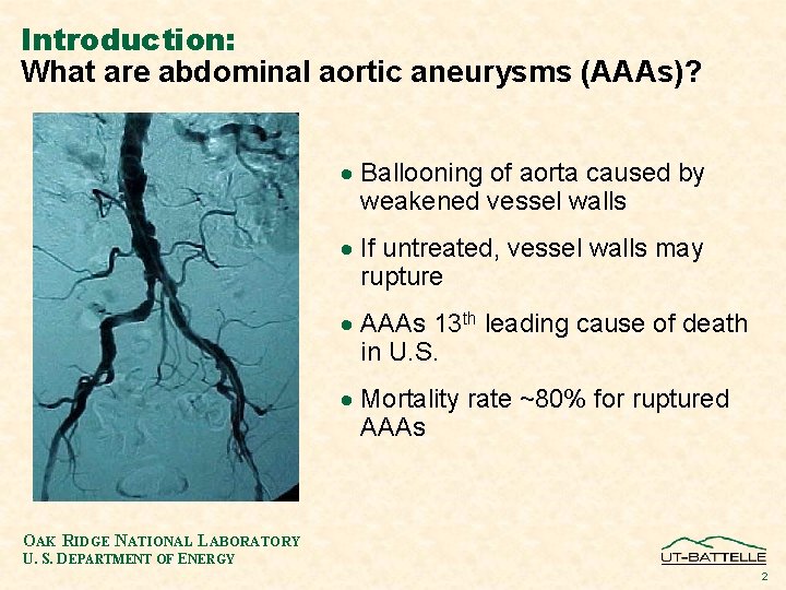 Introduction: What are abdominal aortic aneurysms (AAAs)? · Ballooning of aorta caused by weakened