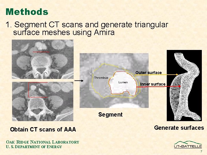 Methods 1. Segment CT scans and generate triangular surface meshes using Amira Outer surface