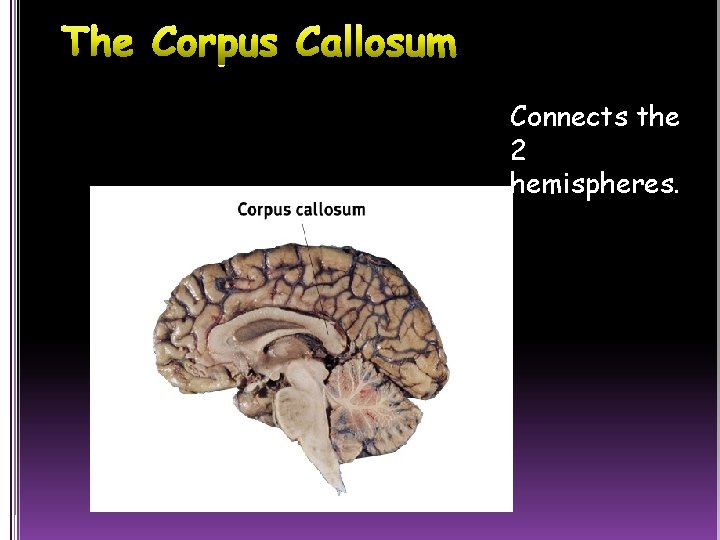 Connects the 2 hemispheres. 