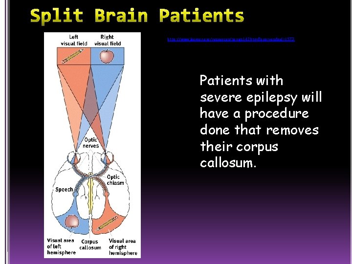 http: //www. learner. org/resources/series 142. html? pop=yes&pid=1573 Patients with severe epilepsy will have a