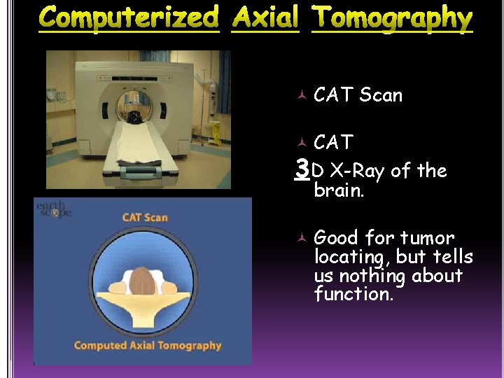  CAT Scan CAT 3 D X-Ray of the brain. Good for tumor locating,
