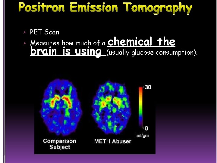  PET Scan Measures how much of a brain is using chemical the (usually