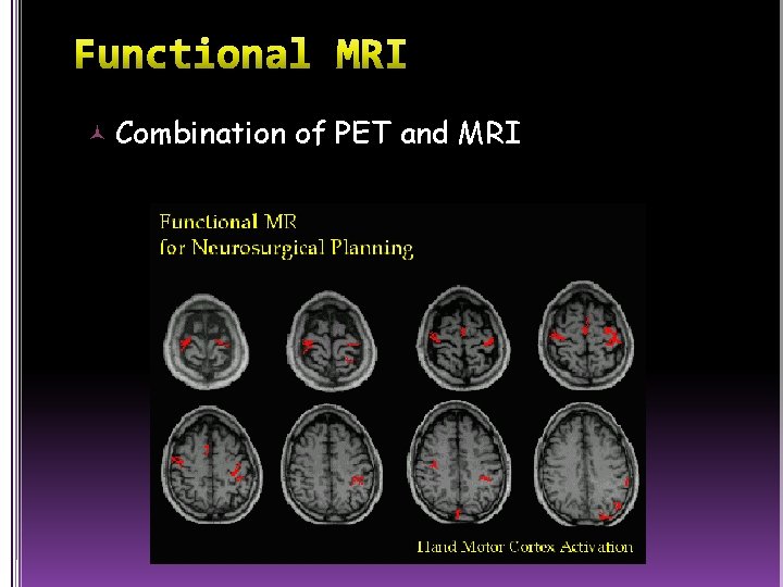  Combination of PET and MRI 