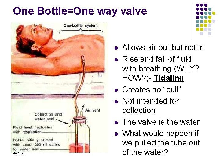 One Bottle=One way valve l l l 9/9/2020 Allows air out but not in