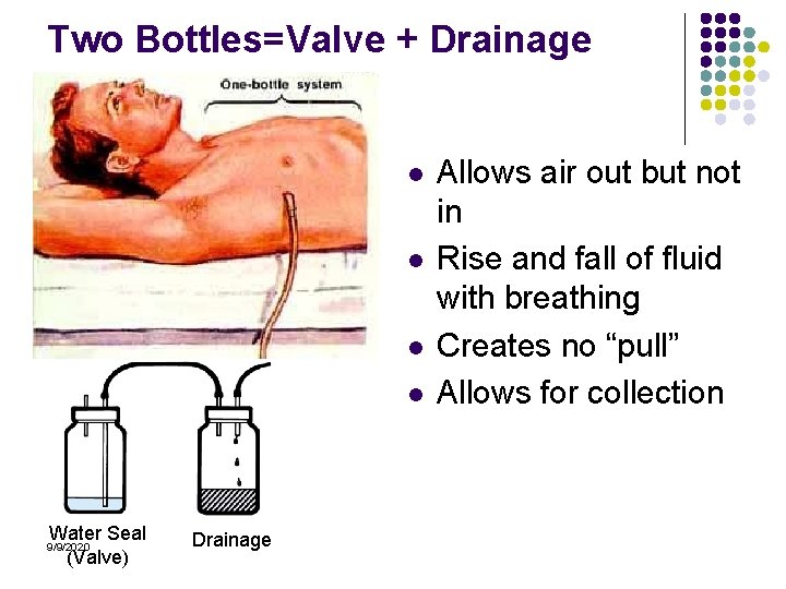 Two Bottles=Valve + Drainage l l Water Seal (Valve) 9/9/2020 Drainage Allows air out