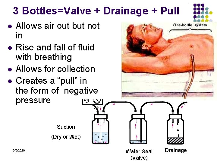 3 Bottles=Valve + Drainage + Pull l l Allows air out but not in
