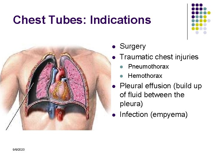 Chest Tubes: Indications l l Surgery Traumatic chest injuries l l 9/9/2020 Pneumothorax Hemothorax