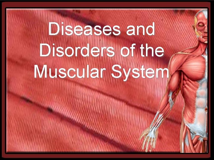 Diseases and Disorders of the Muscular System 