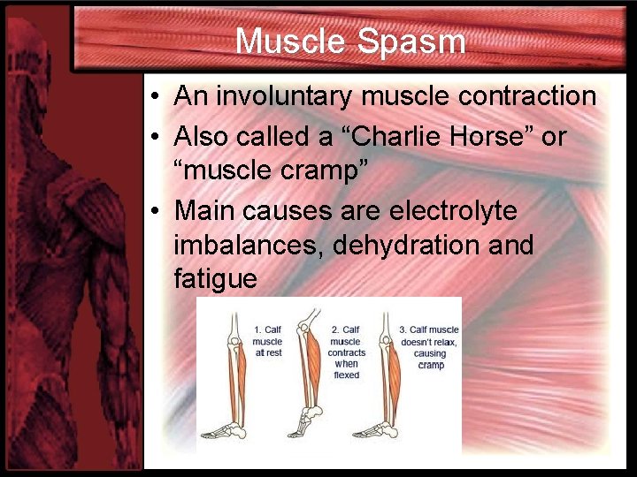 Muscle Spasm • An involuntary muscle contraction • Also called a “Charlie Horse” or