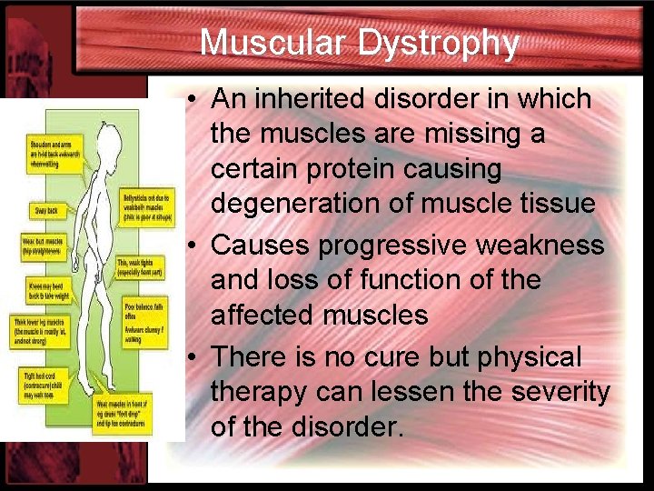 Muscular Dystrophy • An inherited disorder in which the muscles are missing a certain