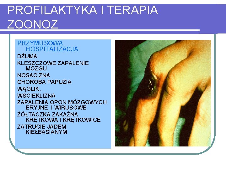 PROFILAKTYKA I TERAPIA ZOONOZ PRZYMUSOWA HOSPITALIZACJA DŻUMA KLESZCZOWE ZAPALENIE MÓZGU NOSACIZNA CHOROBA PAPUZIA WĄGLIK,