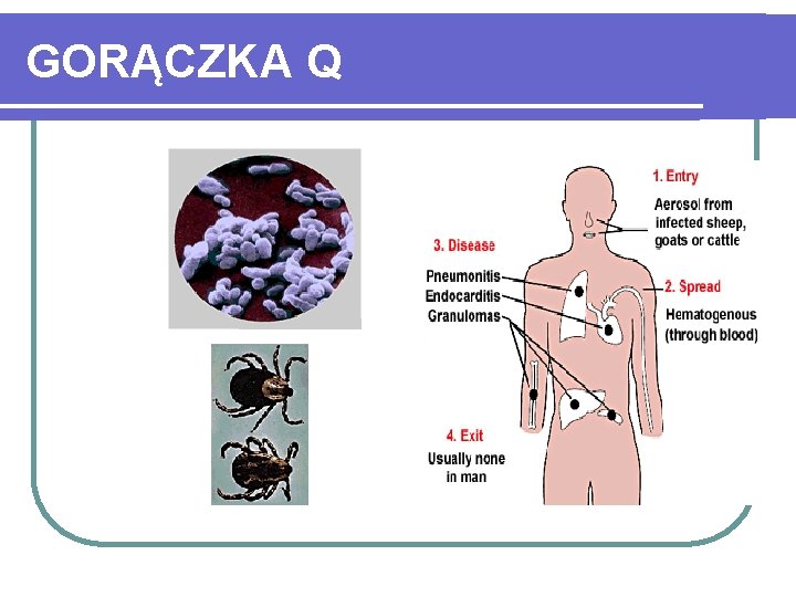 GORĄCZKA Q 