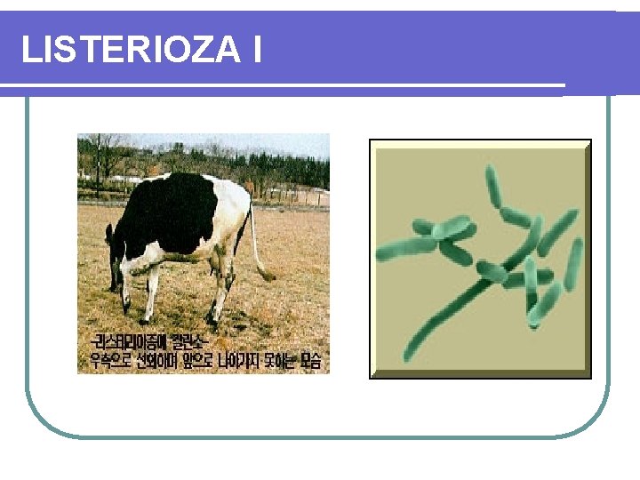 LISTERIOZA I 