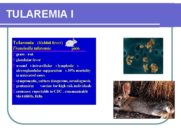 TULAREMIA I 