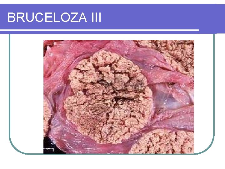 BRUCELOZA III 
