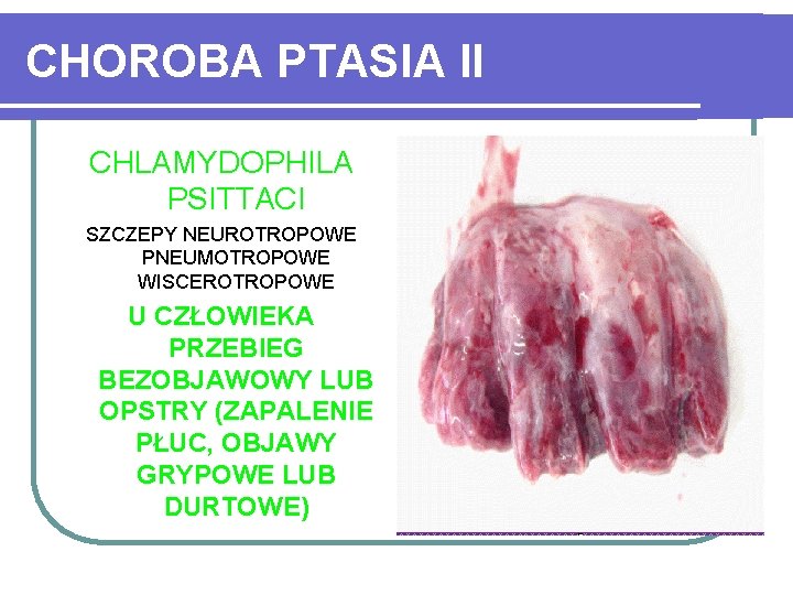 CHOROBA PTASIA II CHLAMYDOPHILA PSITTACI SZCZEPY NEUROTROPOWE PNEUMOTROPOWE WISCEROTROPOWE U CZŁOWIEKA PRZEBIEG BEZOBJAWOWY LUB