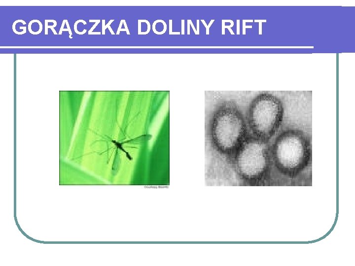 GORĄCZKA DOLINY RIFT 