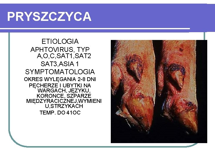 PRYSZCZYCA ETIOLOGIA APHTOVIRUS, TYP A, O, C, SAT 1, SAT 2 SAT 3, ASIA