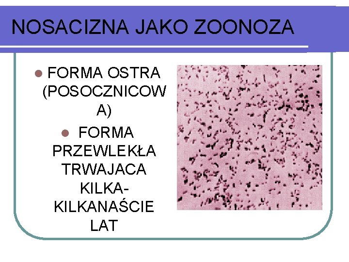 NOSACIZNA JAKO ZOONOZA l FORMA OSTRA (POSOCZNICOW A) l FORMA PRZEWLEKŁA TRWAJACA KILKANAŚCIE LAT