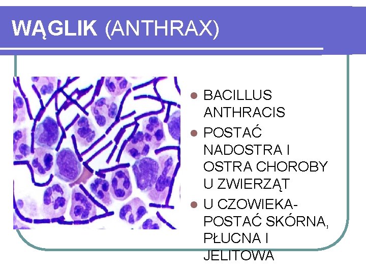 WĄGLIK (ANTHRAX) BACILLUS ANTHRACIS l POSTAĆ NADOSTRA I OSTRA CHOROBY U ZWIERZĄT l U