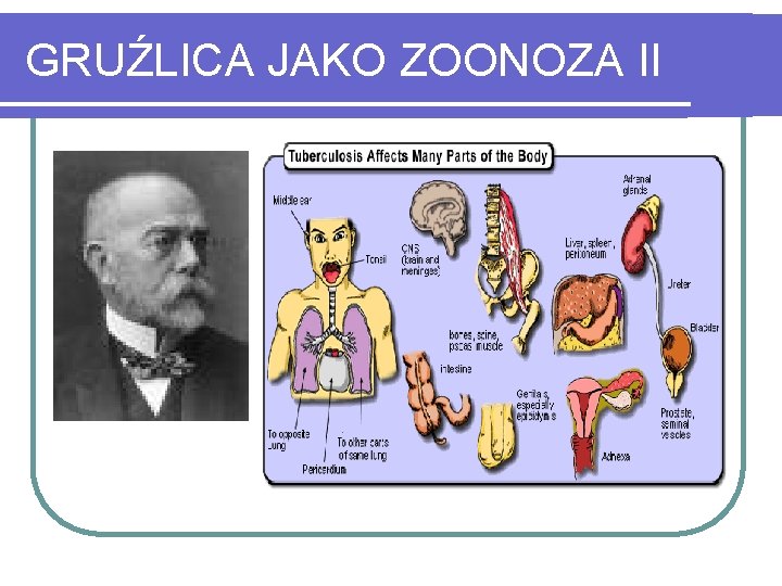 GRUŹLICA JAKO ZOONOZA II 