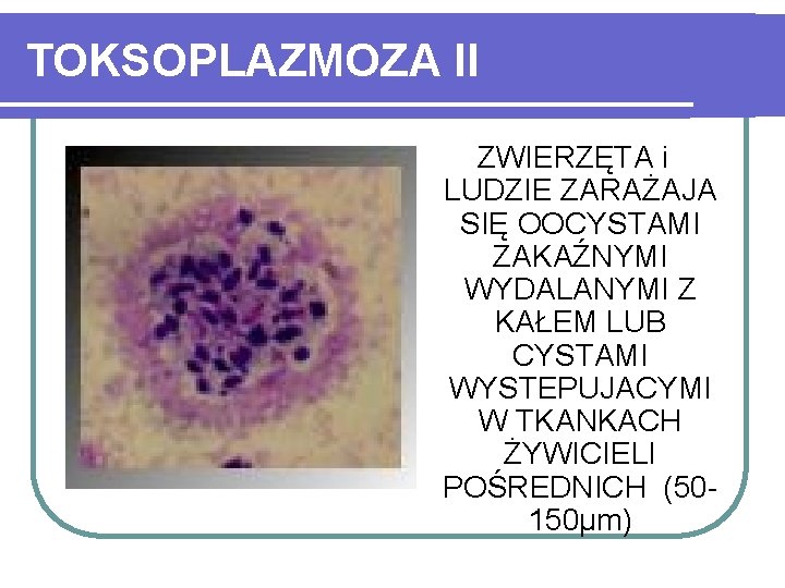 TOKSOPLAZMOZA II ZWIERZĘTA i LUDZIE ZARAŻAJA SIĘ OOCYSTAMI ZAKAŹNYMI WYDALANYMI Z KAŁEM LUB CYSTAMI