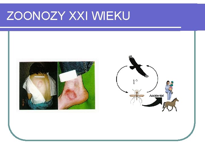 ZOONOZY XXI WIEKU 