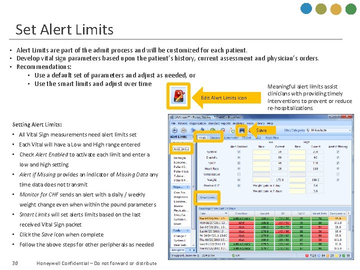 Set Alert Limits • Alert Limits are part of the admit process and will