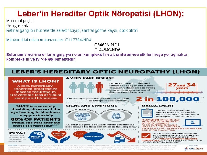 Leber’in Herediter Optik Nöropatisi (LHON): Maternal geçişli Genç, erkek Retinal ganglion hücrelerde selektif kayıp,