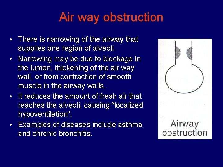 Air way obstruction • There is narrowing of the airway that supplies one region