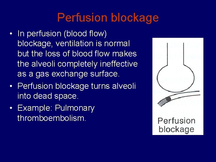 Perfusion blockage • In perfusion (blood flow) blockage, ventilation is normal but the loss