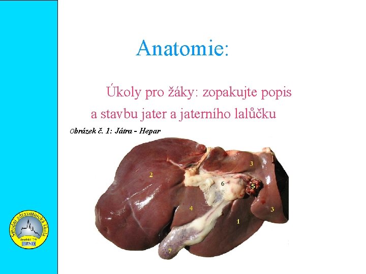 Anatomie: Úkoly pro žáky: zopakujte popis a stavbu jater a jaterního lalůčku Obrázek č.