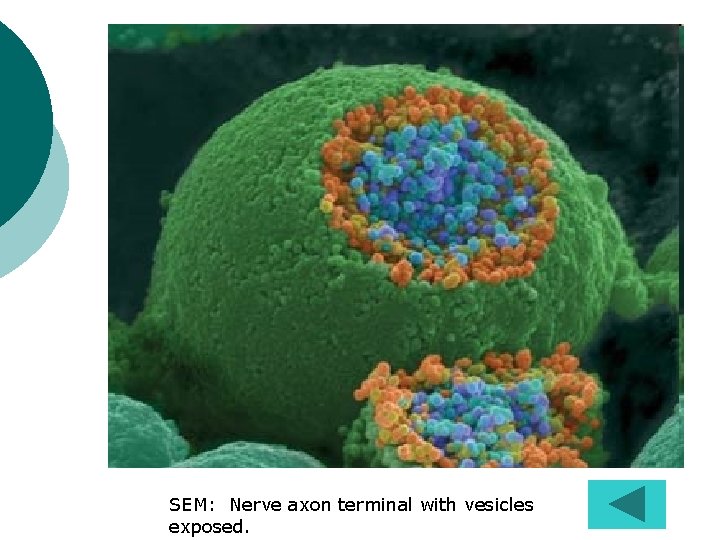 SEM: Nerve axon terminal with vesicles exposed. 