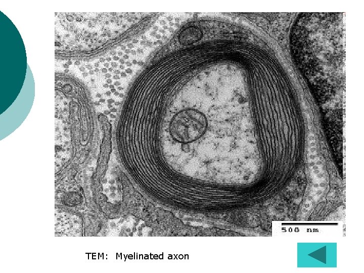 TEM: Myelinated axon 