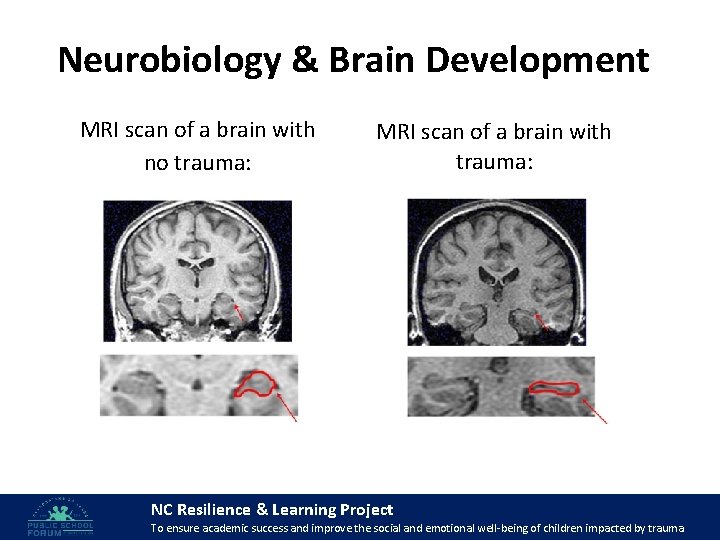 Neurobiology & Brain Development MRI scan of a brain with no trauma: MRI scan