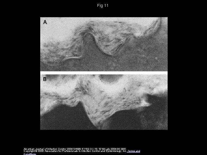 Fig 11 American Journal of Infection Control 2006 34 S 98 -S 110 DOI: