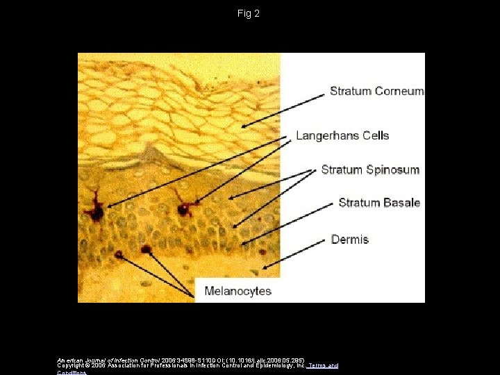 Fig 2 American Journal of Infection Control 2006 34 S 98 -S 110 DOI: