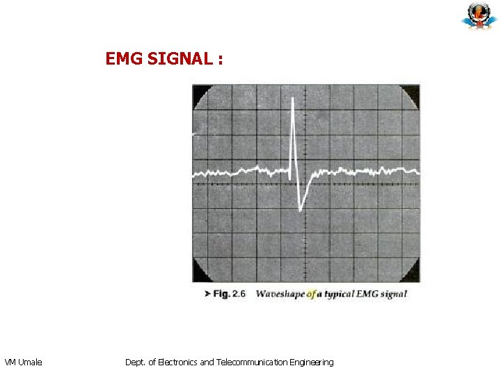 EMG SIGNAL : VM Umale Dept. of Electronics and Telecommunication Engineering 