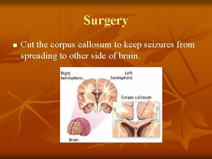 Surgery n Cut the corpus callosum to keep seizures from spreading to other side