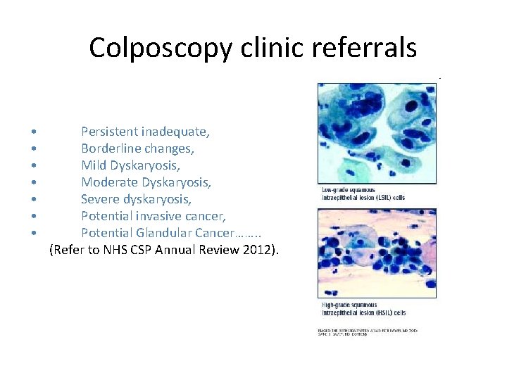 Colposcopy clinic referrals • • Persistent inadequate, Borderline changes, Mild Dyskaryosis, Moderate Dyskaryosis, Severe