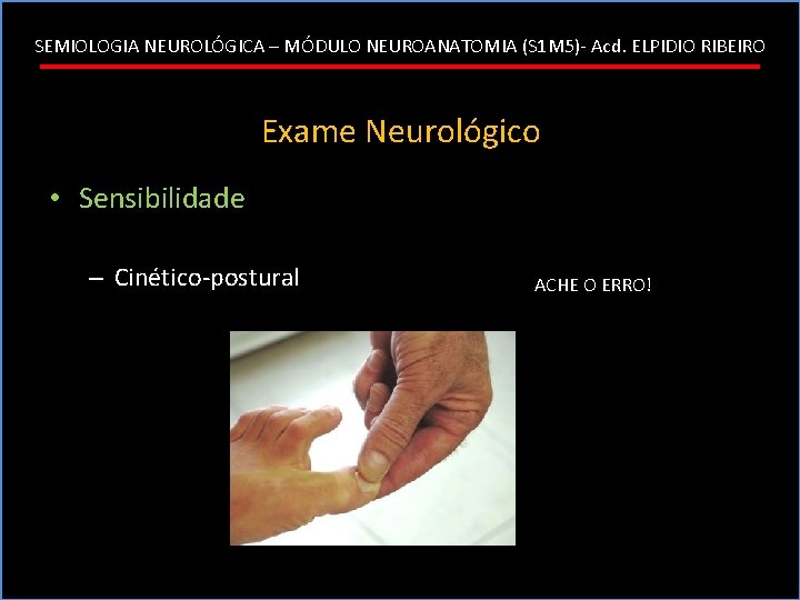 SEMIOLOGIA NEUROLÓGICA – MÓDULO NEUROANATOMIA (S 1 M 5)- Acd. ELPIDIO RIBEIRO Exame Neurológico