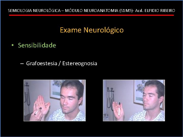 SEMIOLOGIA NEUROLÓGICA – MÓDULO NEUROANATOMIA (S 1 M 5)- Acd. ELPIDIO RIBEIRO Exame Neurológico