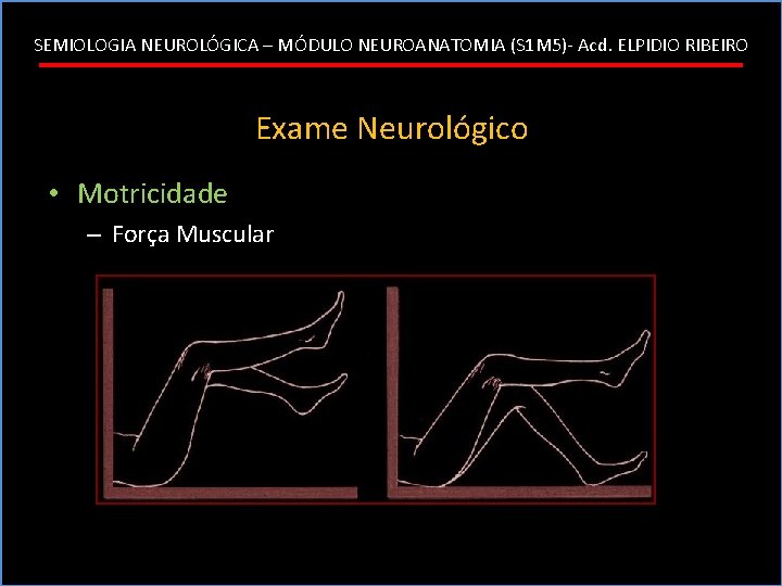 SEMIOLOGIA NEUROLÓGICA – MÓDULO NEUROANATOMIA (S 1 M 5)- Acd. ELPIDIO RIBEIRO Exame Neurológico