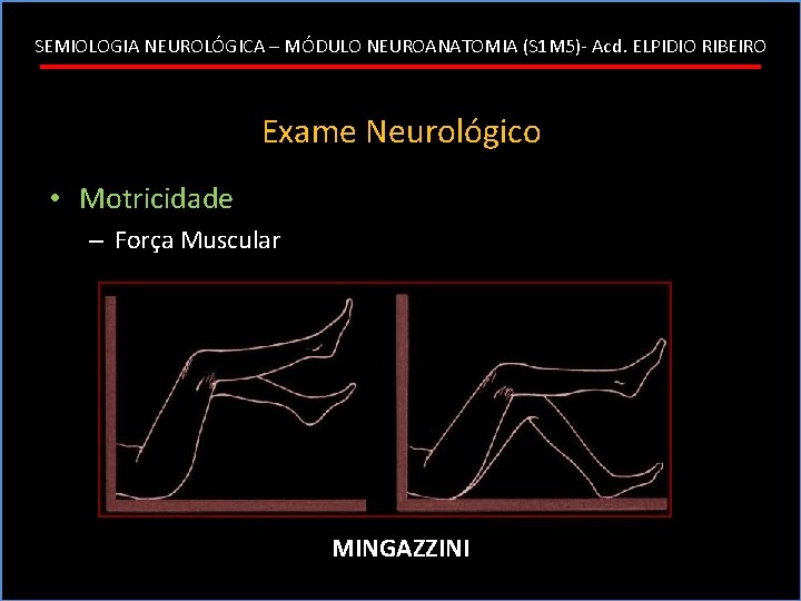 SEMIOLOGIA NEUROLÓGICA – MÓDULO NEUROANATOMIA (S 1 M 5)- Acd. ELPIDIO RIBEIRO Exame Neurológico