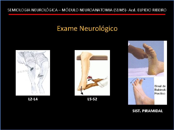 SEMIOLOGIA NEUROLÓGICA – MÓDULO NEUROANATOMIA (S 1 M 5)- Acd. ELPIDIO RIBEIRO Exame Neurológico