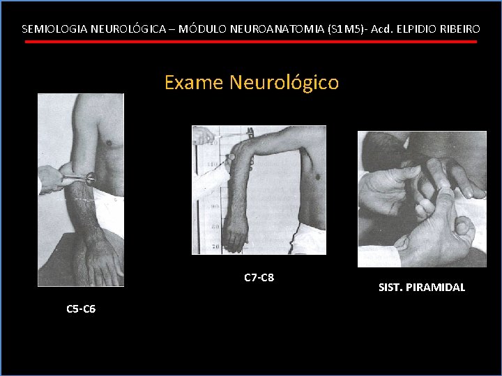 SEMIOLOGIA NEUROLÓGICA – MÓDULO NEUROANATOMIA (S 1 M 5)- Acd. ELPIDIO RIBEIRO Exame Neurológico