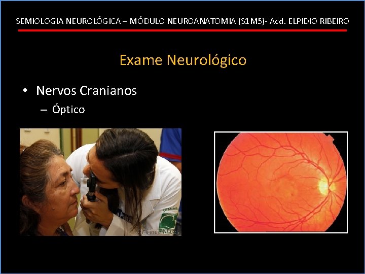 SEMIOLOGIA NEUROLÓGICA – MÓDULO NEUROANATOMIA (S 1 M 5)- Acd. ELPIDIO RIBEIRO Exame Neurológico